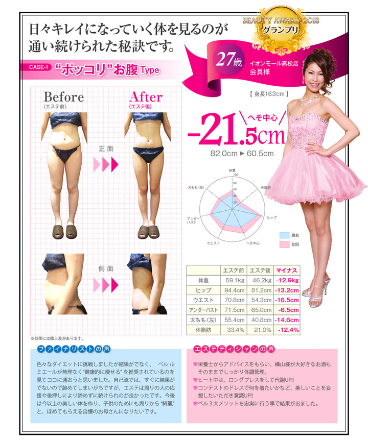 ポッコリお腹Type