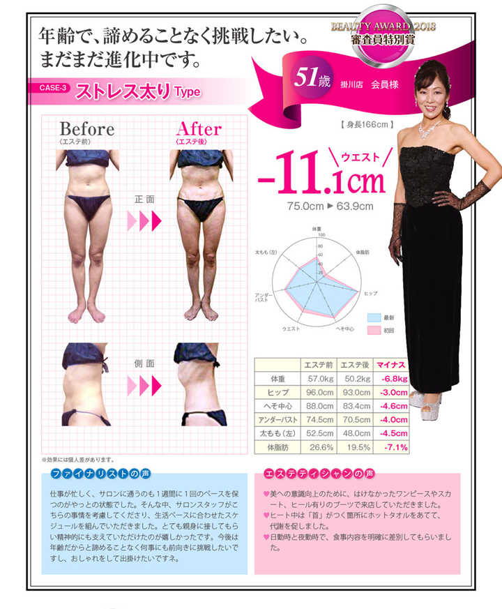 ストレス太りType